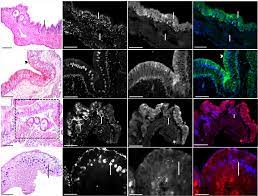 Parallel evolution of placental calcium transfer in the lizard Mabuya and eutherian mammals